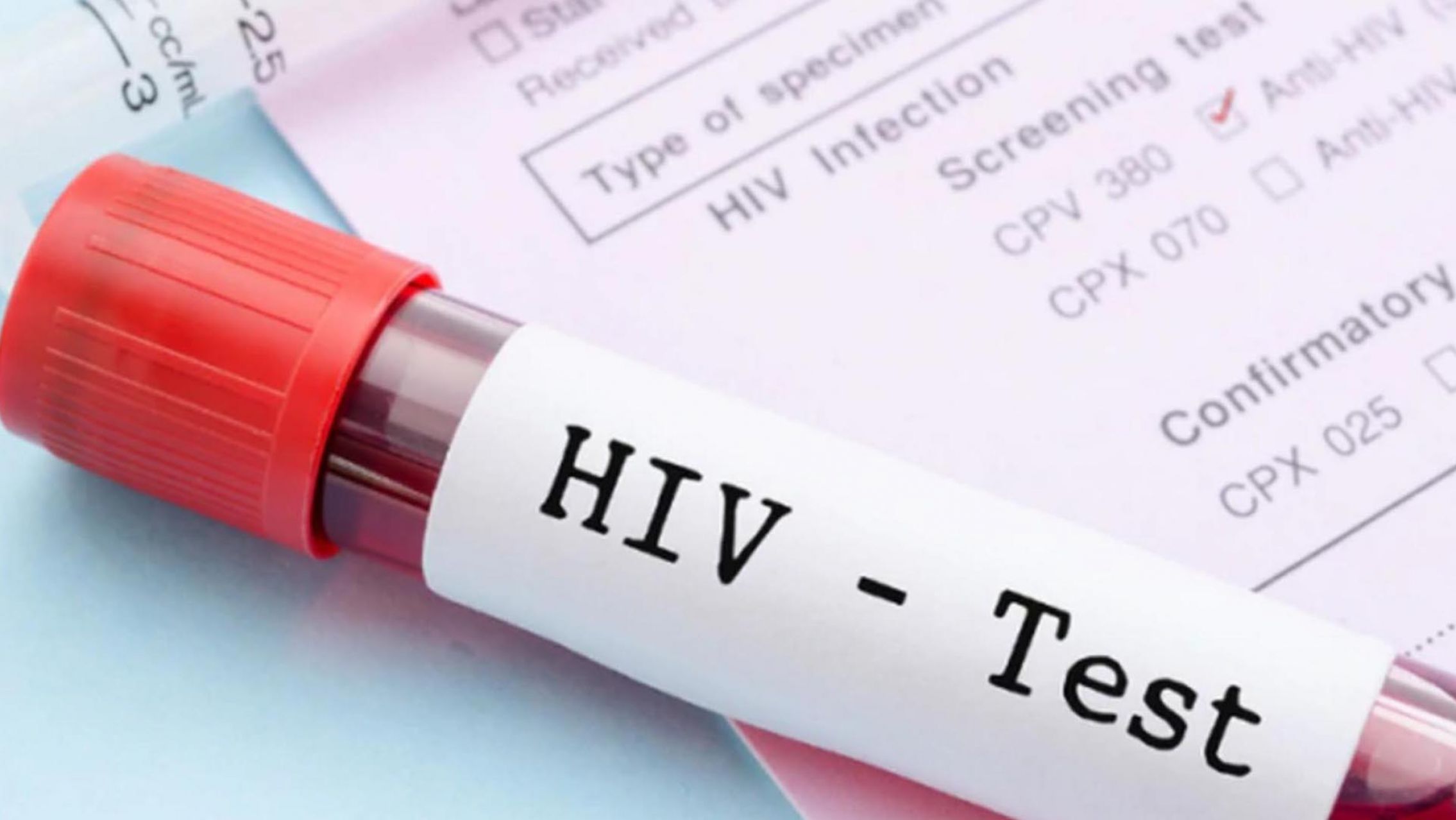 Casi la mitad de los diagnósticos de VIH se dan en forma tardía en Argentina