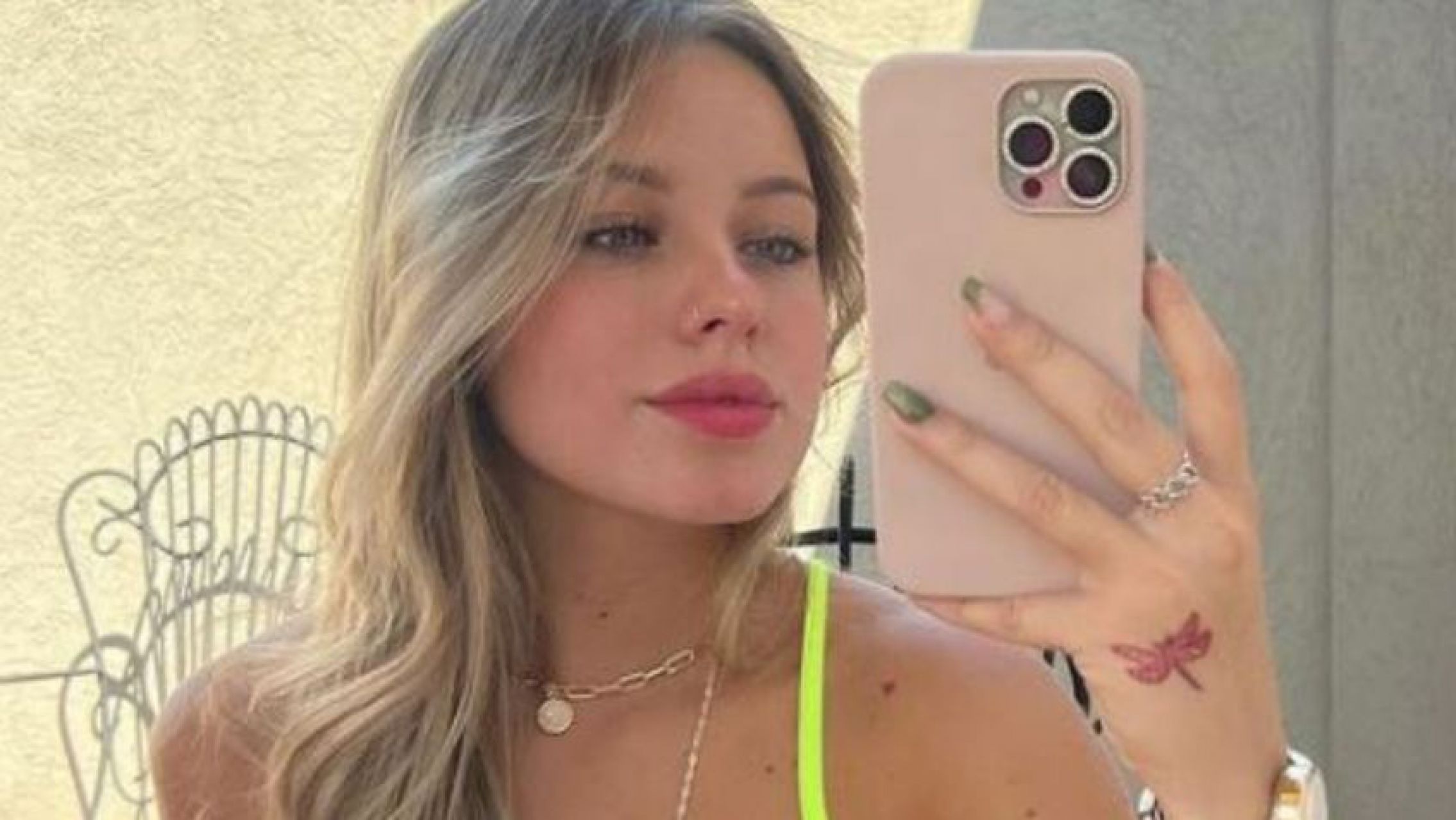 Coti Romero de Gran Hermano nuevamente se retocó el rostro: ¿Qué se hizo?