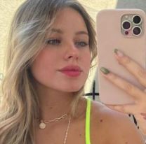 Coti Romero de Gran Hermano nuevamente se retocó el rostro: ¿Qué se hizo?