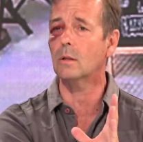 El periodista de canal América que reapareció con su rostro desfigurado tras sufrir un robo