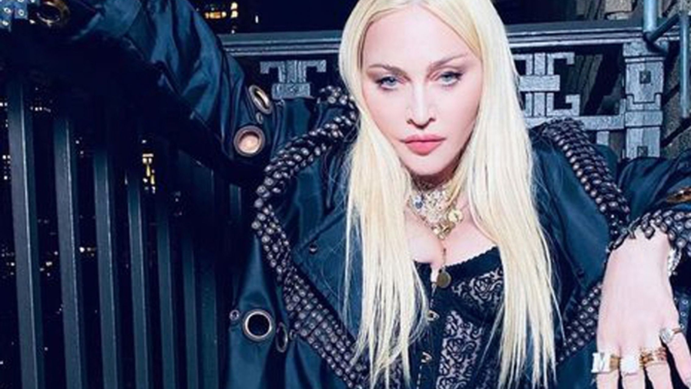 El estado de salud de Madonna: ¿Qué le pasó?