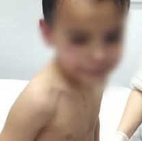 Locura en Castelar: discutieron en un partido de fútbol, lo baleó e hirió al hijo de 6 años