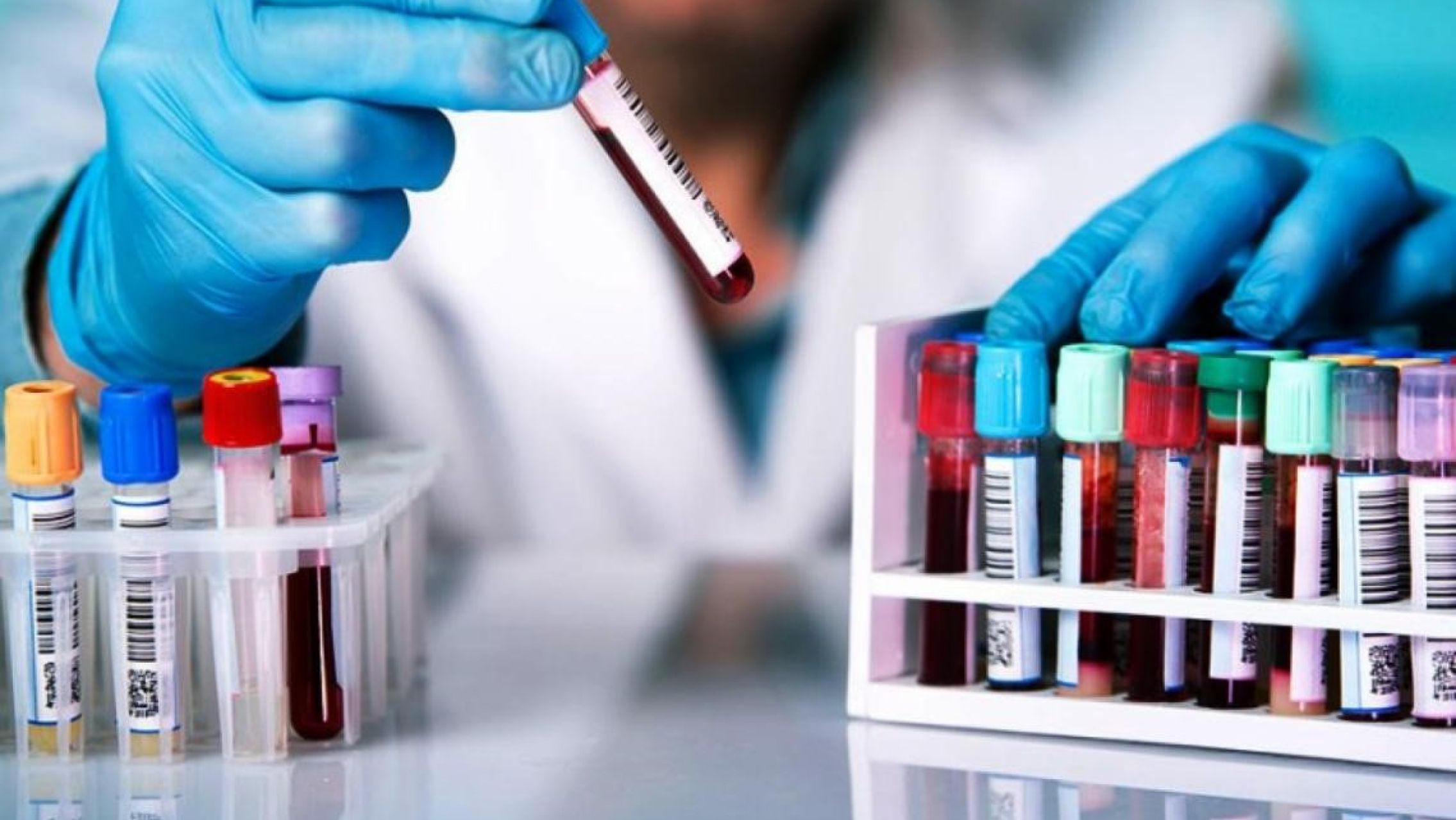 Bioquímicos alertan por costos triplicados y laboratorios con riesgo de cierre tras las "devastadoras" medidas económicas