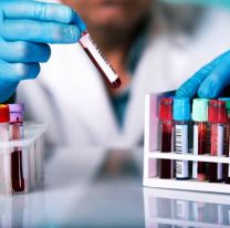 Bioquímicos alertan por costos triplicados y laboratorios con riesgo de cierre tras las "devastadoras" medidas económicas