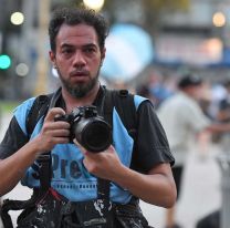 Varios trabajadores de prensa resultaron heridos por balas de goma durante la represión