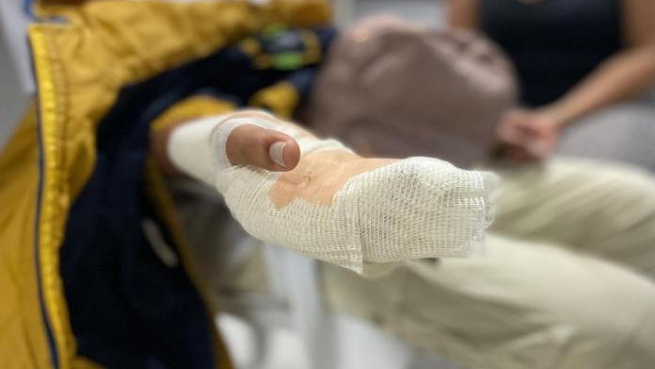 Un hombre se prendió fuego mientras intentaba arreglar su auto