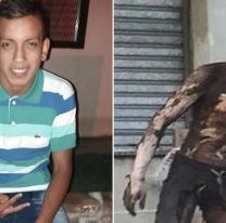 Falleció el joven que intentó robar cables en Rosario y sufrió quemaduras de gravedad