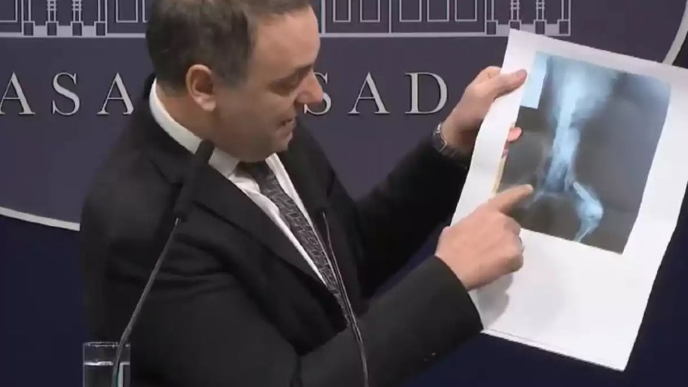 Milei ordena auditoría masiva de pensiones por invalidez tras detectar irregularidades