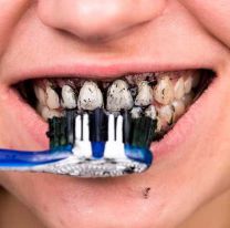 ANMAT prohibió una marca de productos para blanquear los dientes: tiralo ya