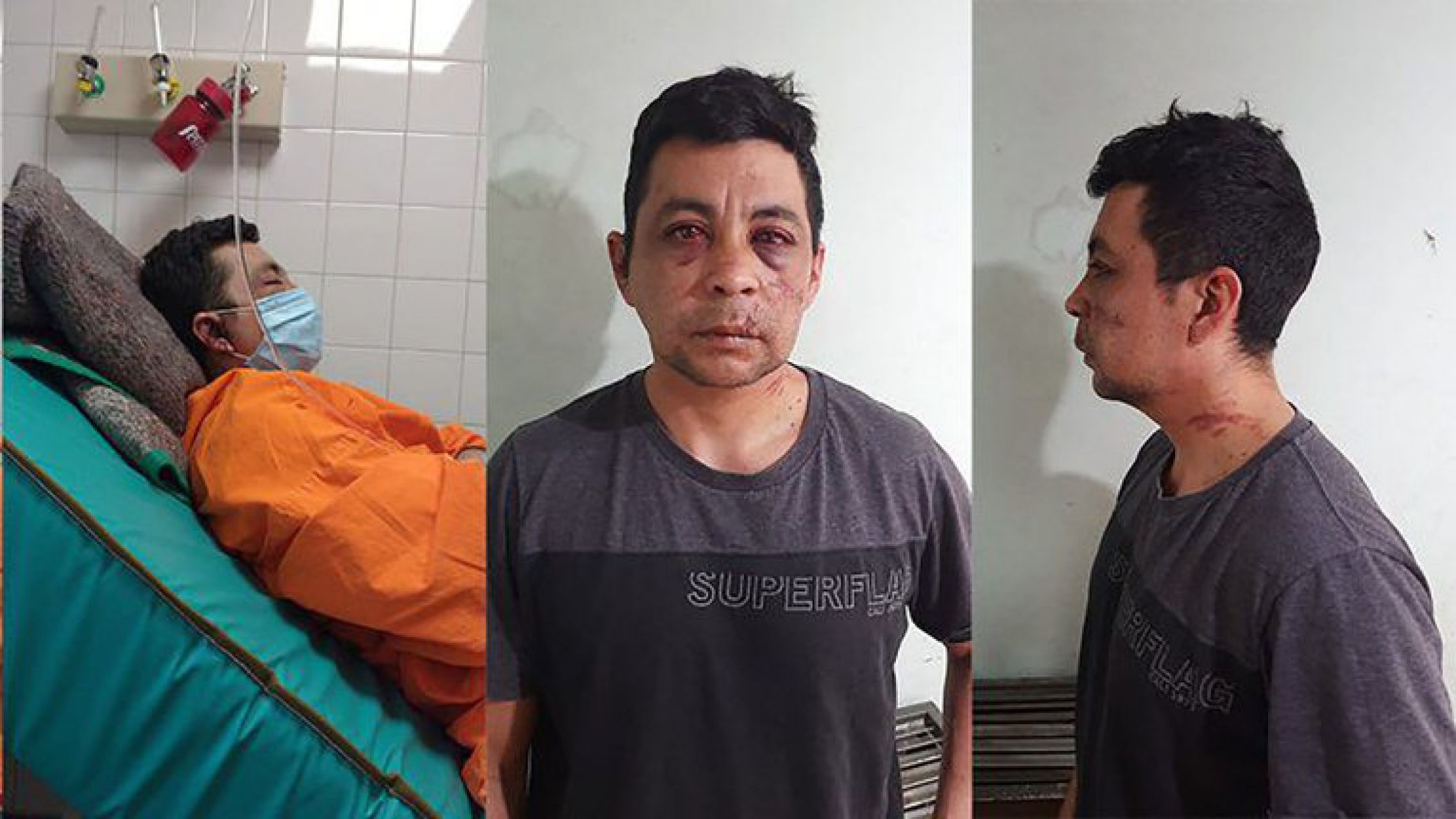 Consecuencia del terror que siembran los medios: Un enfermero recuperado de Covid19 fue golpeado por vecinos y le incendiaron la casa