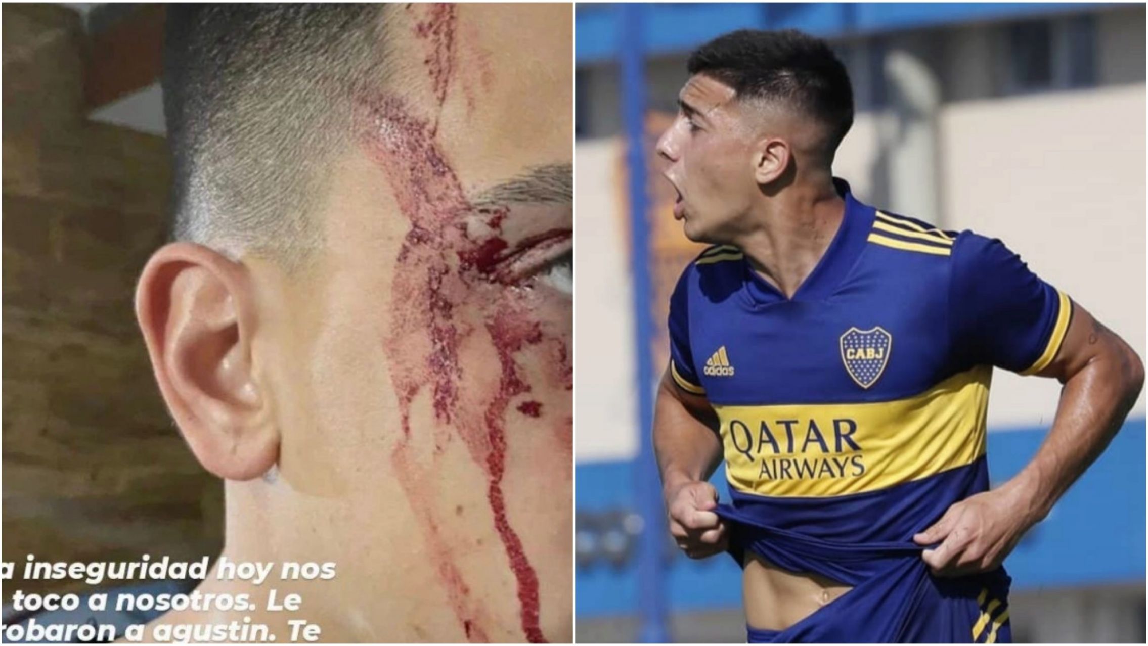 Violento asalto a Agustín Sandez reabre la discusión sobre la edad de imputabilidad