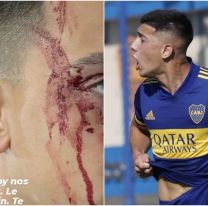 Violento asalto a Agustín Sandez reabre la discusión sobre la edad de imputabilidad