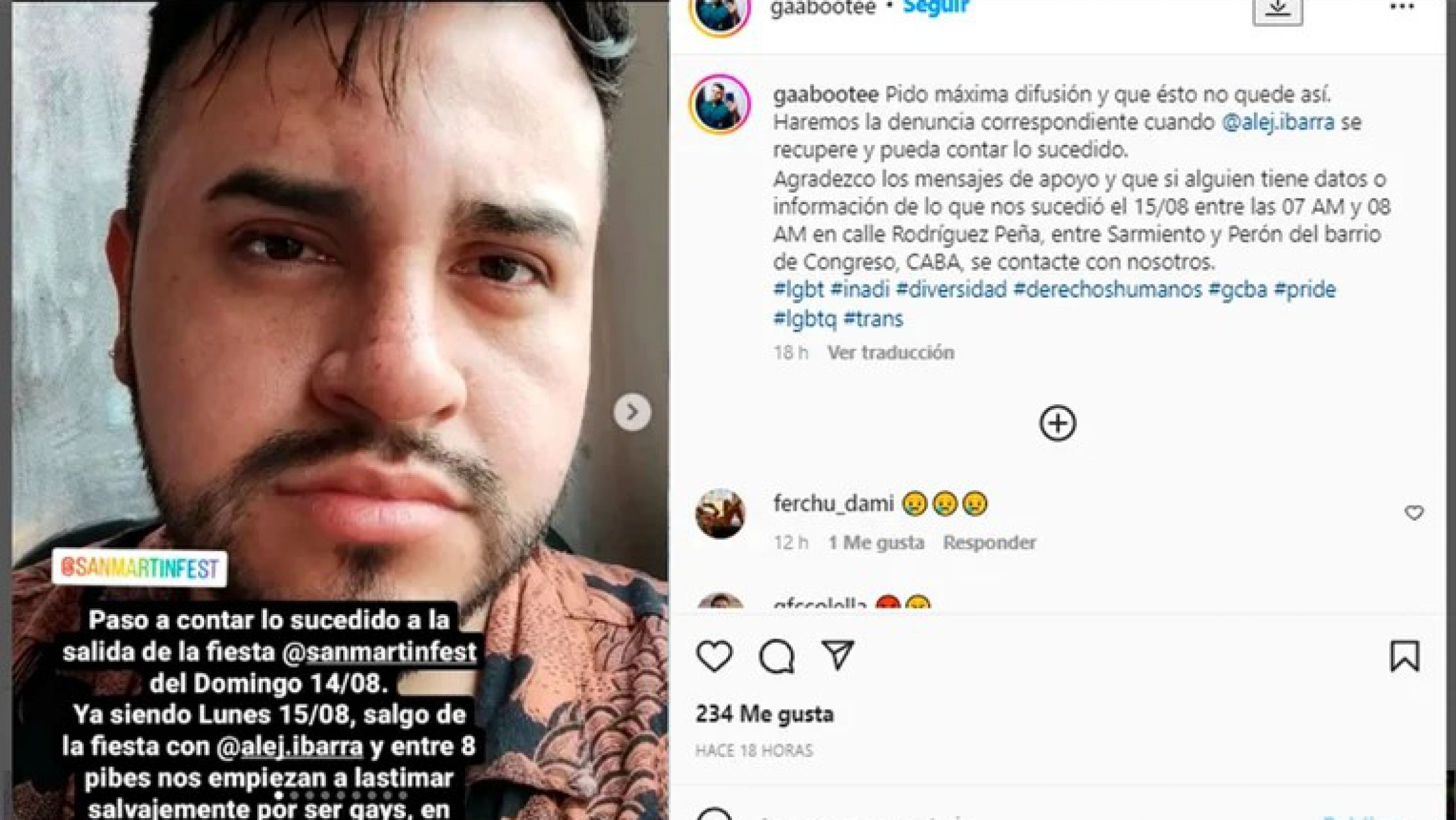 "Nos apedrearon salvajemente por ser gays", terrible ataque homofóbico