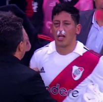 ¿Qué dice el parte médico de Rodrigo Aliendro? El jugador se pierde lo que queda de la temporada